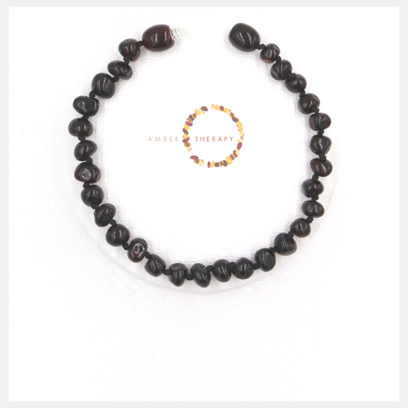 Adult Cherry Amber Bracelet